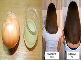 Đơn giản từ hành tây và chanh Hinh anh: Don gian tu hanh tay va chanh