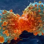 Tại sao ung thư tấn công giết chết con người