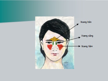 Bệnh viêm xoang là gì?